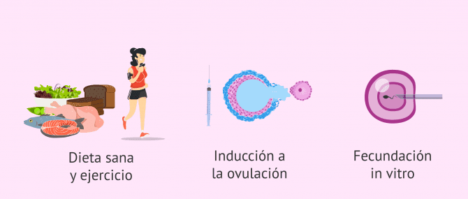 Imagen: tratamiento-embarazo-sop