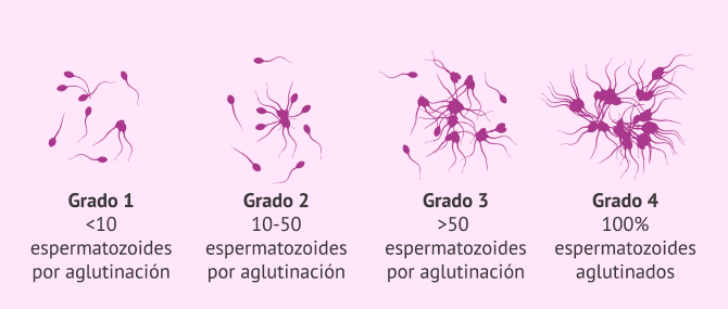 Cuanto Tiempo Viven Los Espermatozoides Al Aire Libre - Leer un Libro