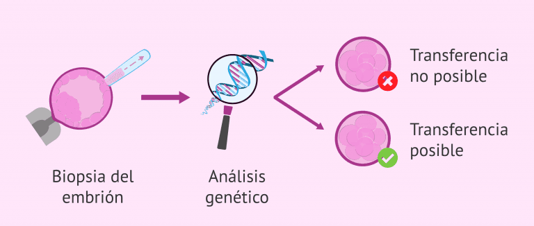 ¿Se puede diagnosticar todas las enfermedades con la biopsia embrionaria?