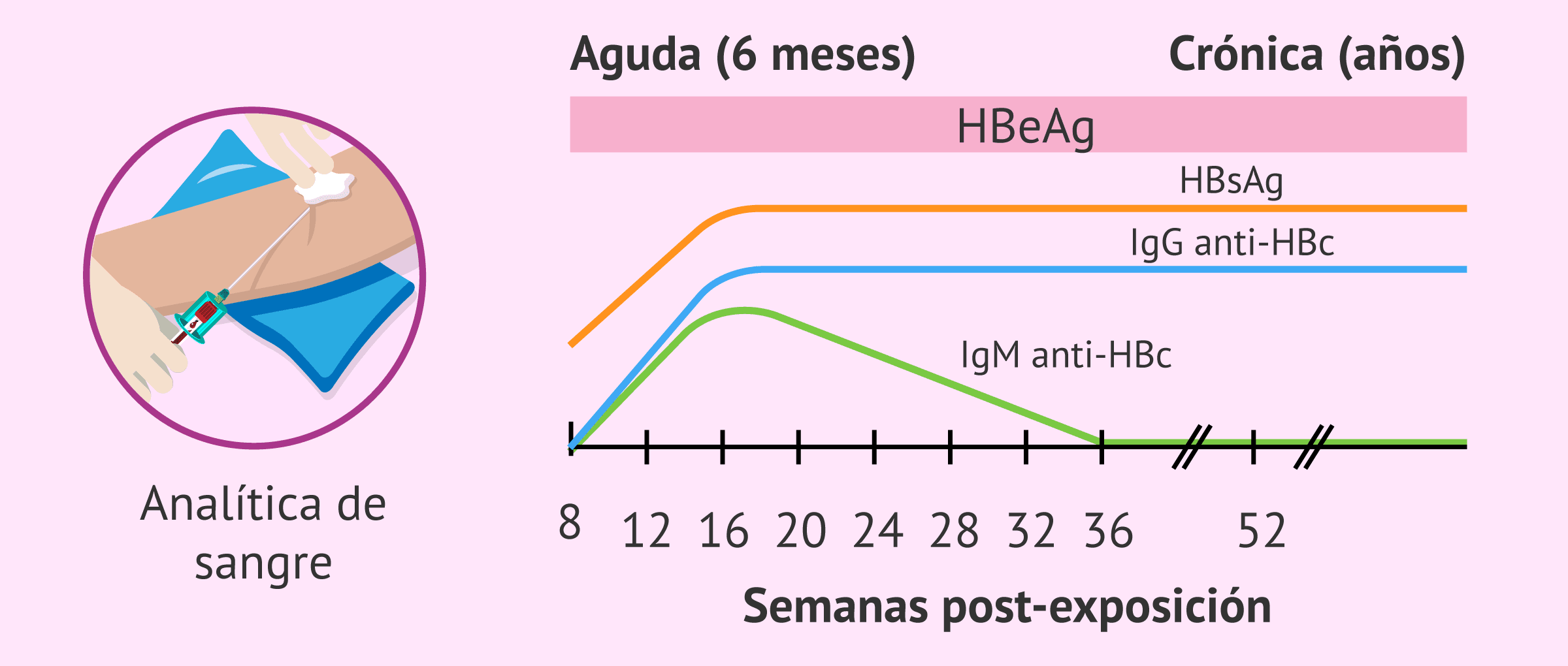 Marcadores para el diagnóstico de la hepatitis B