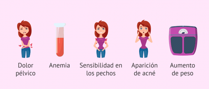 ¿Cómo funciona el DIU? ¿Cuáles son sus ventajas y desventajas?