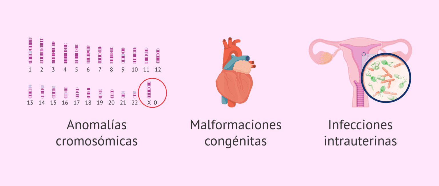 Retardado Causas fetales del crecimiento intrauterino retardado