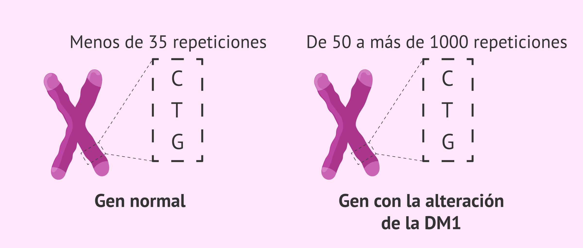 Alteración genética de la distrofia miotónica de Steinert