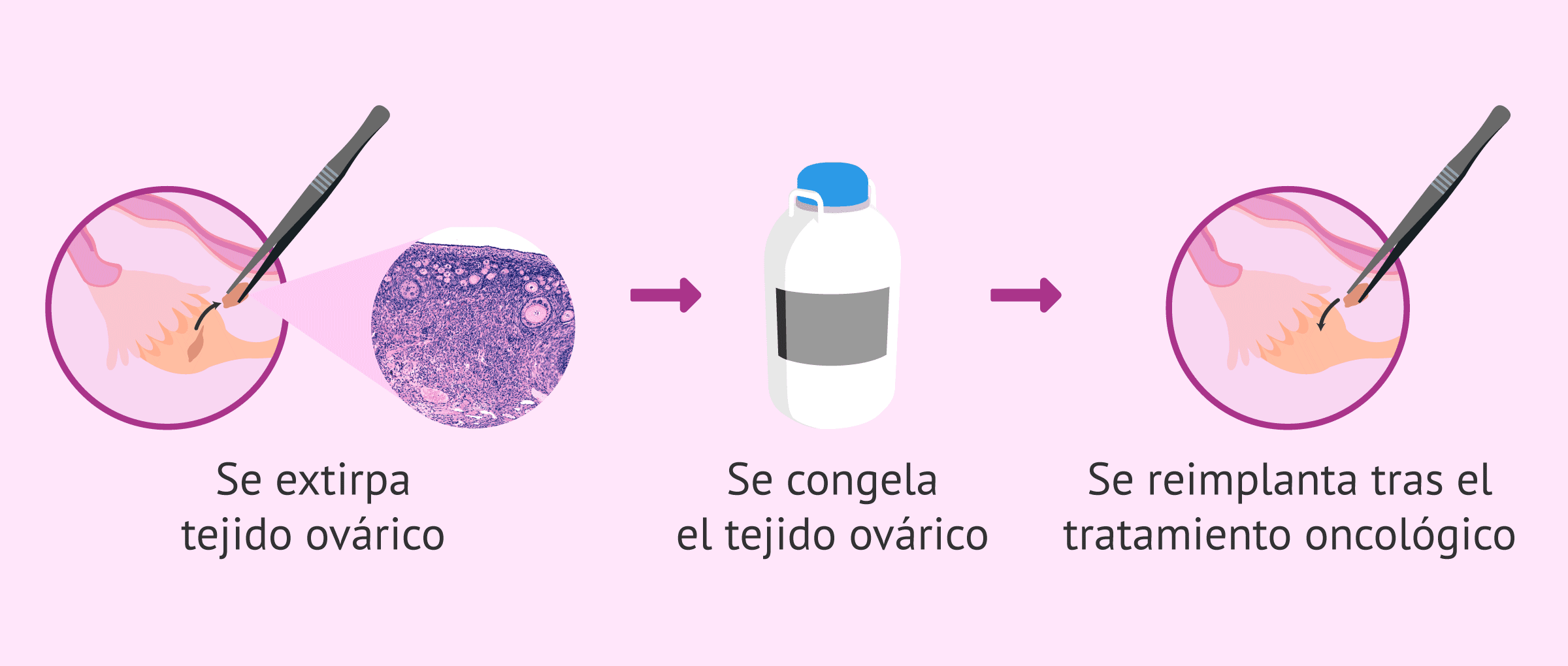 Paso A Paso Para Preservar Tejido Ov rico paso-a-paso-para-preservar-tejido-ov-rico