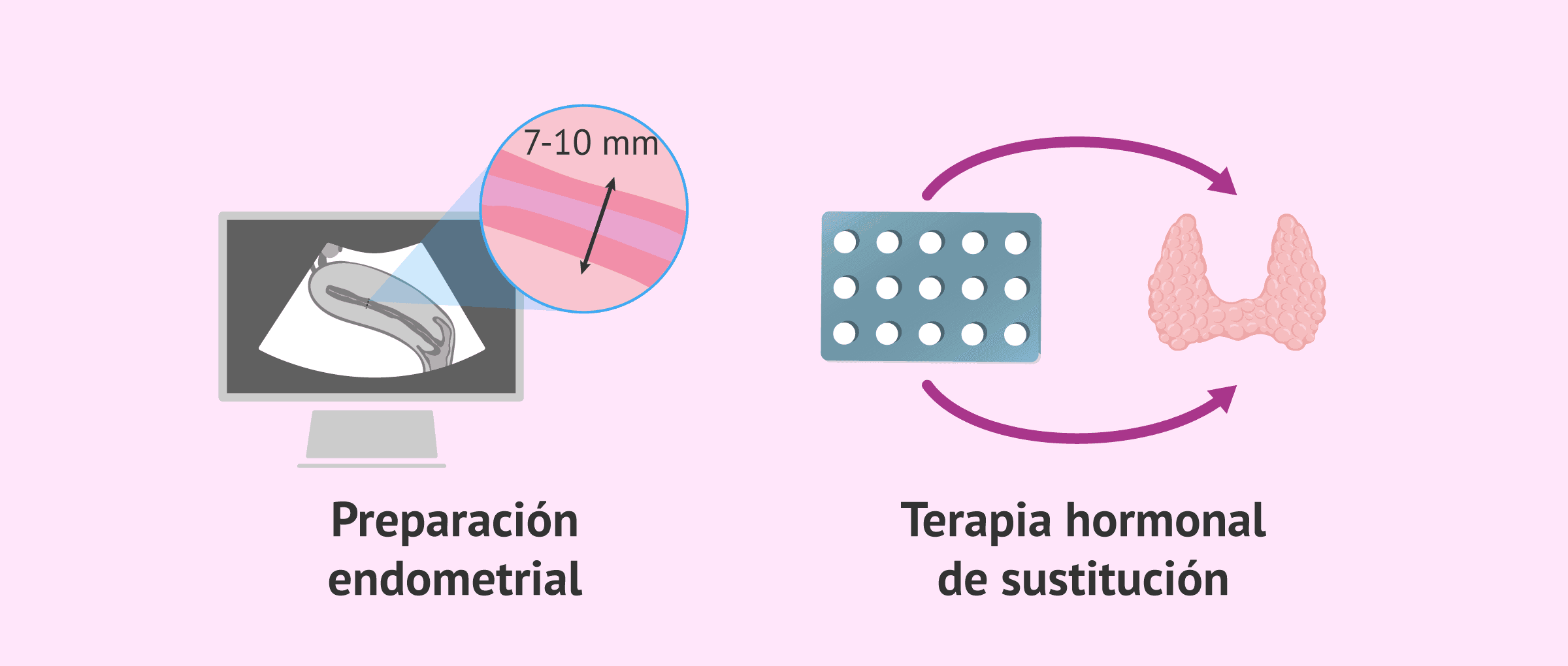 infiltrex contraindicaciones precio