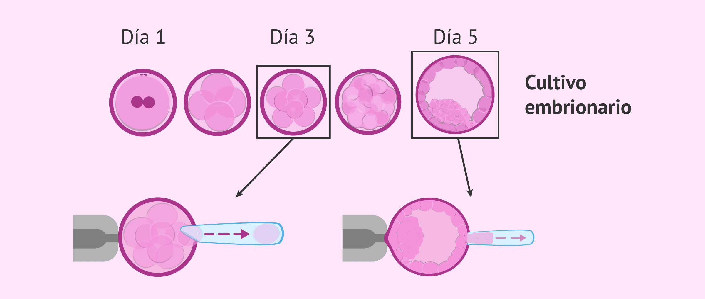 ¿Qué es la biopsia embrionaria y cómo se hace paso a paso?