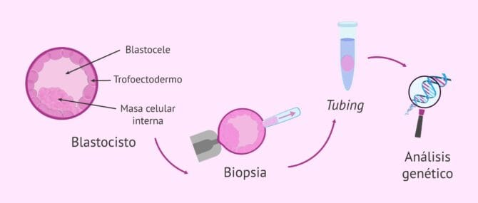 ¿Qué es la biopsia embrionaria y cómo se hace paso a paso?