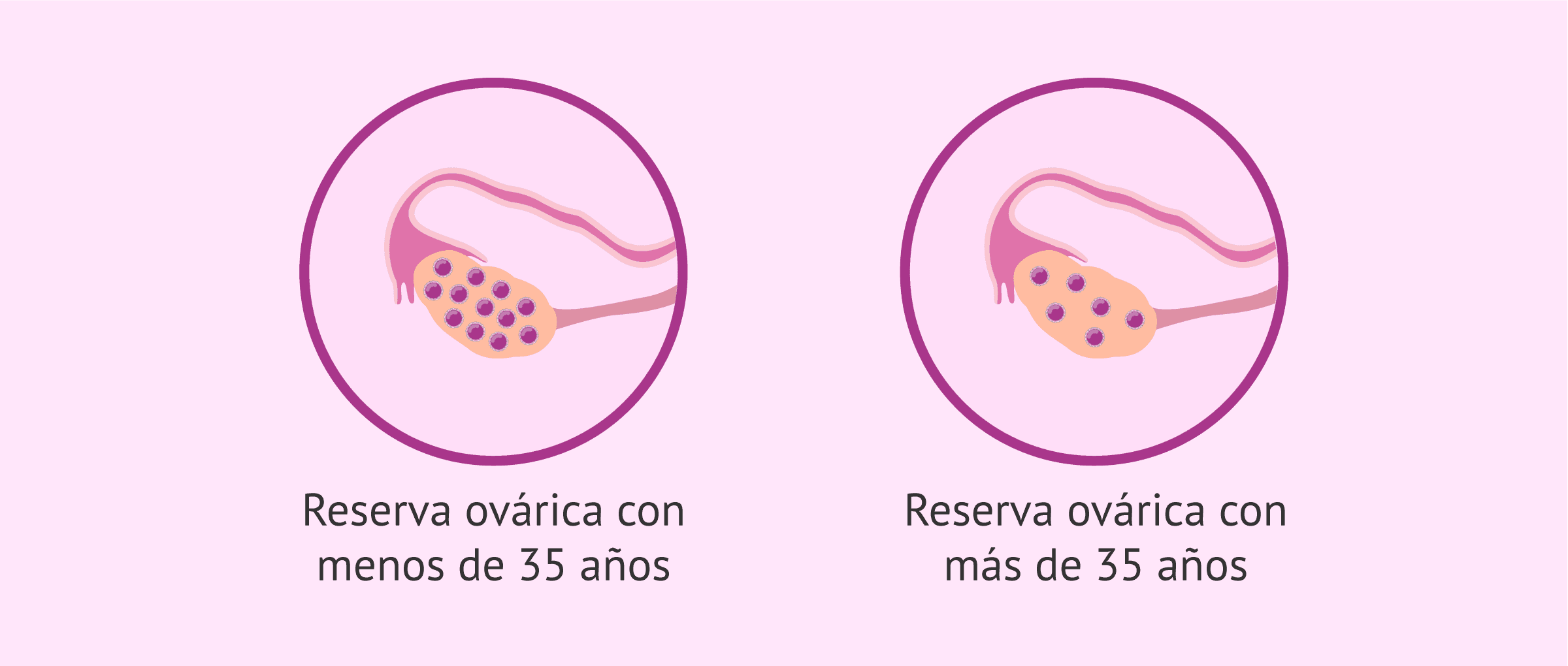 ¿Qué es la reserva ovárica y cómo afecta a la fertilidad?