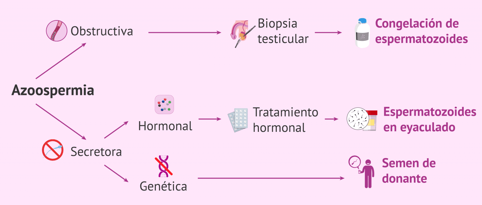 ¿Es posible conseguir el embarazo con azoospermia?