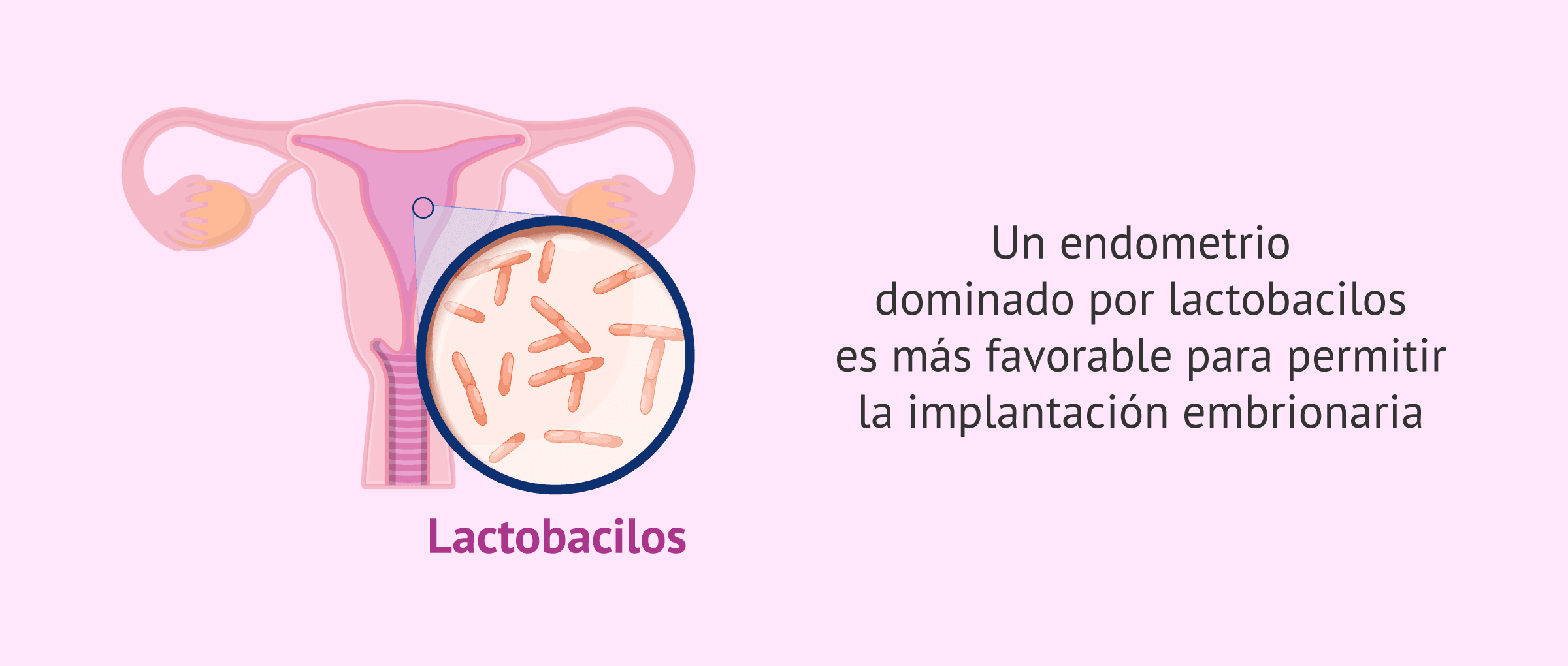 El microbioma endometrial altera el éxito en fecundación in vitro (FIV)