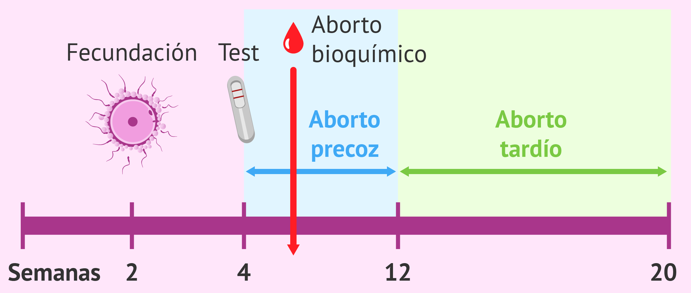 Tipos de aborto espontáneo