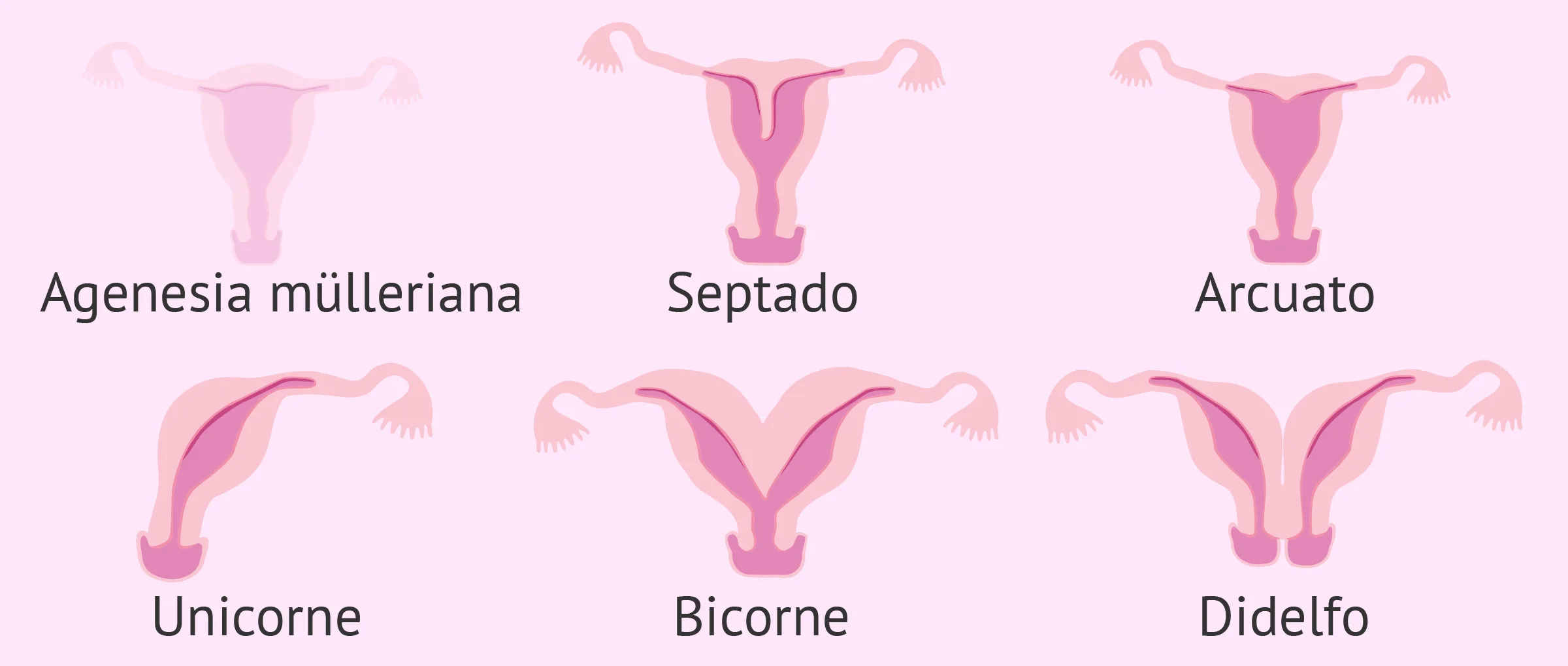 Factor uterino