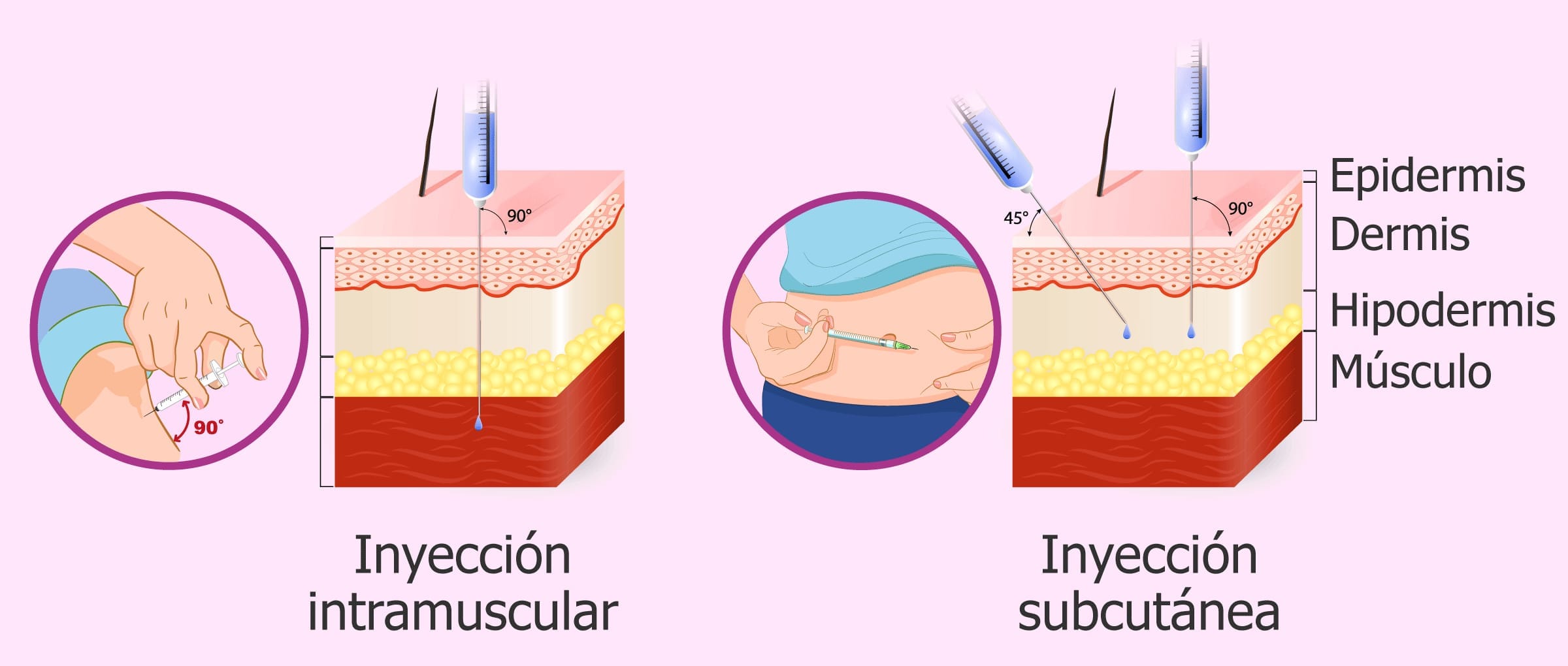 l carnitina doce intramuscular se puede poner subcutaneo Tipos de inyección de Decapeptyl: (mensual) y subcutánea (diaria) Quantity:One-time Purchase APLB Glutathione Niacinamide Body Verified