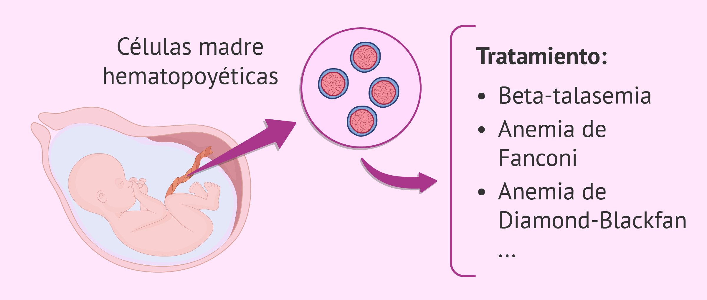 ¿Qué es un “bebé medicamento”? - Indicaciones y casos reales
