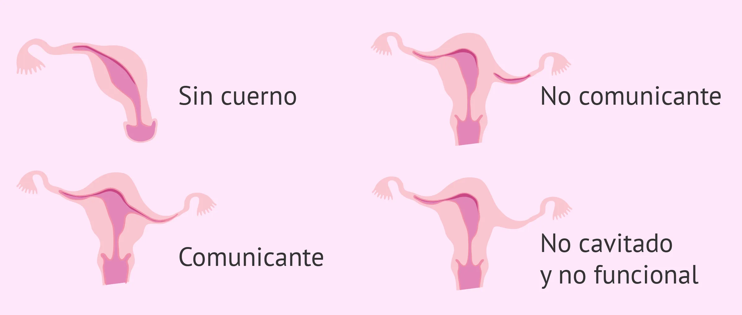 Malformaciones en el útero