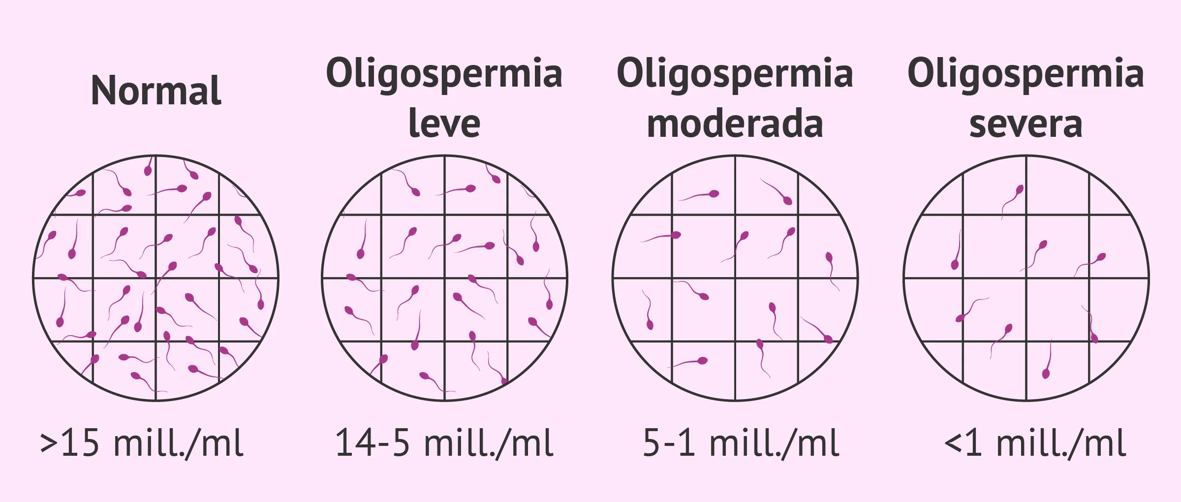 La oligospermia