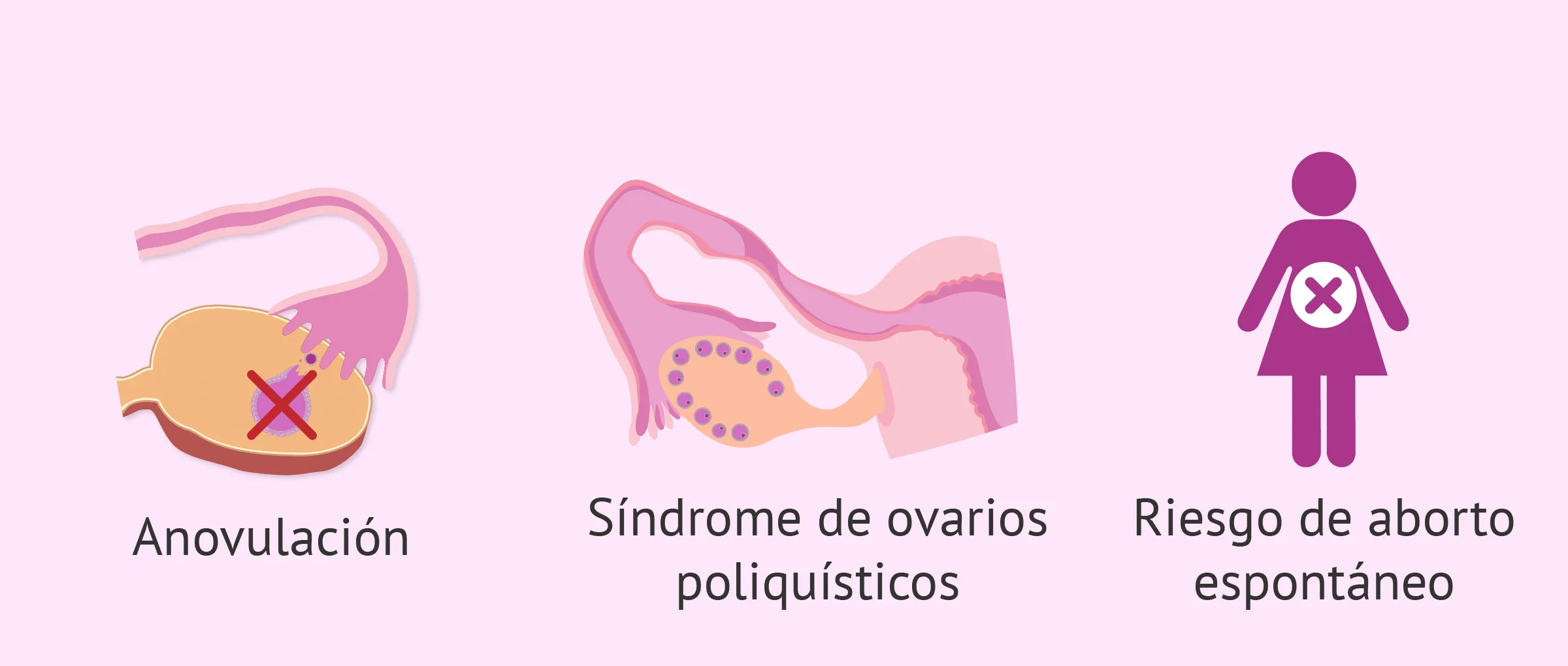 Efectos del sobrepeso en la fertilidad femenina