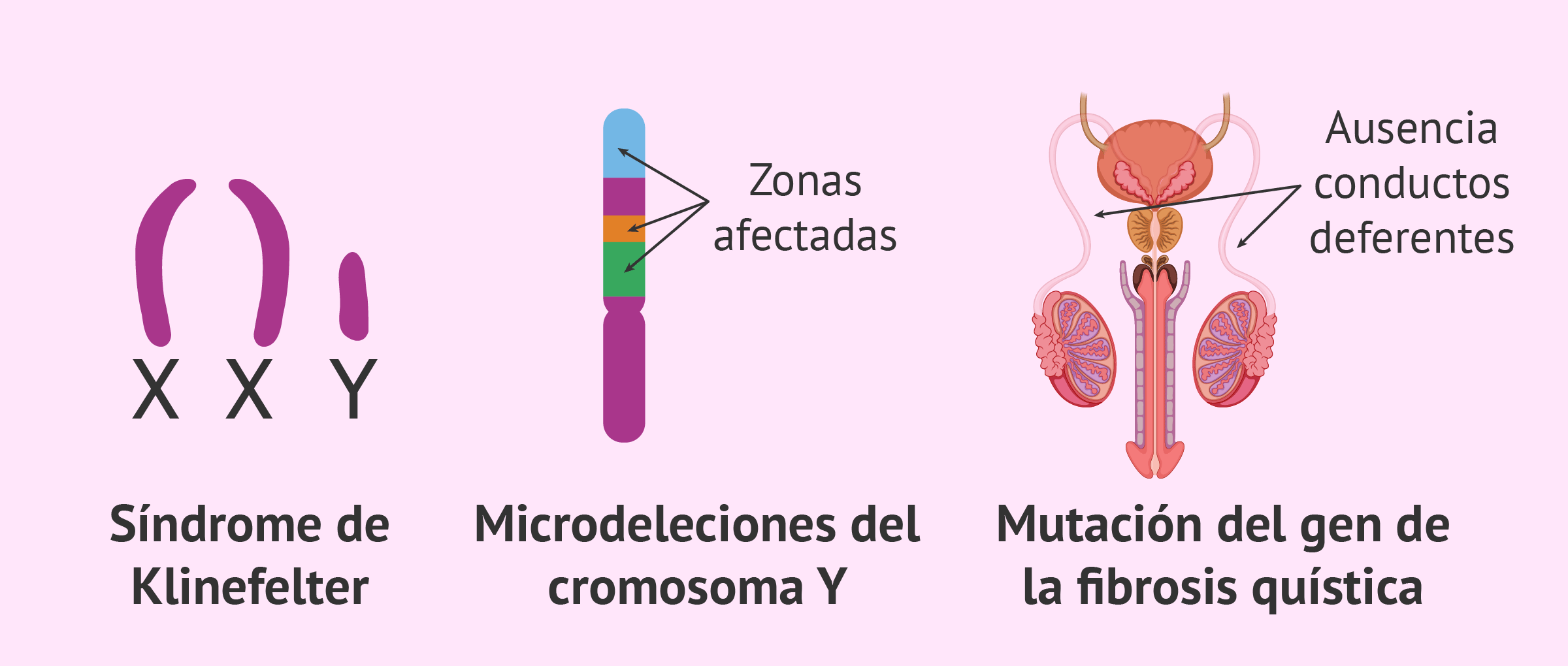 Esterilidad de origen genético: causas, diagnóstico y tratamiento