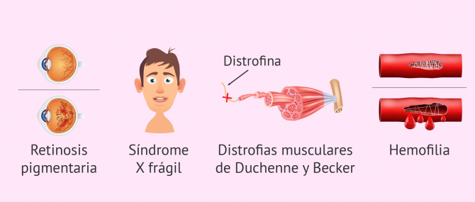 Imagen: Enfermedades ligadas al sexo