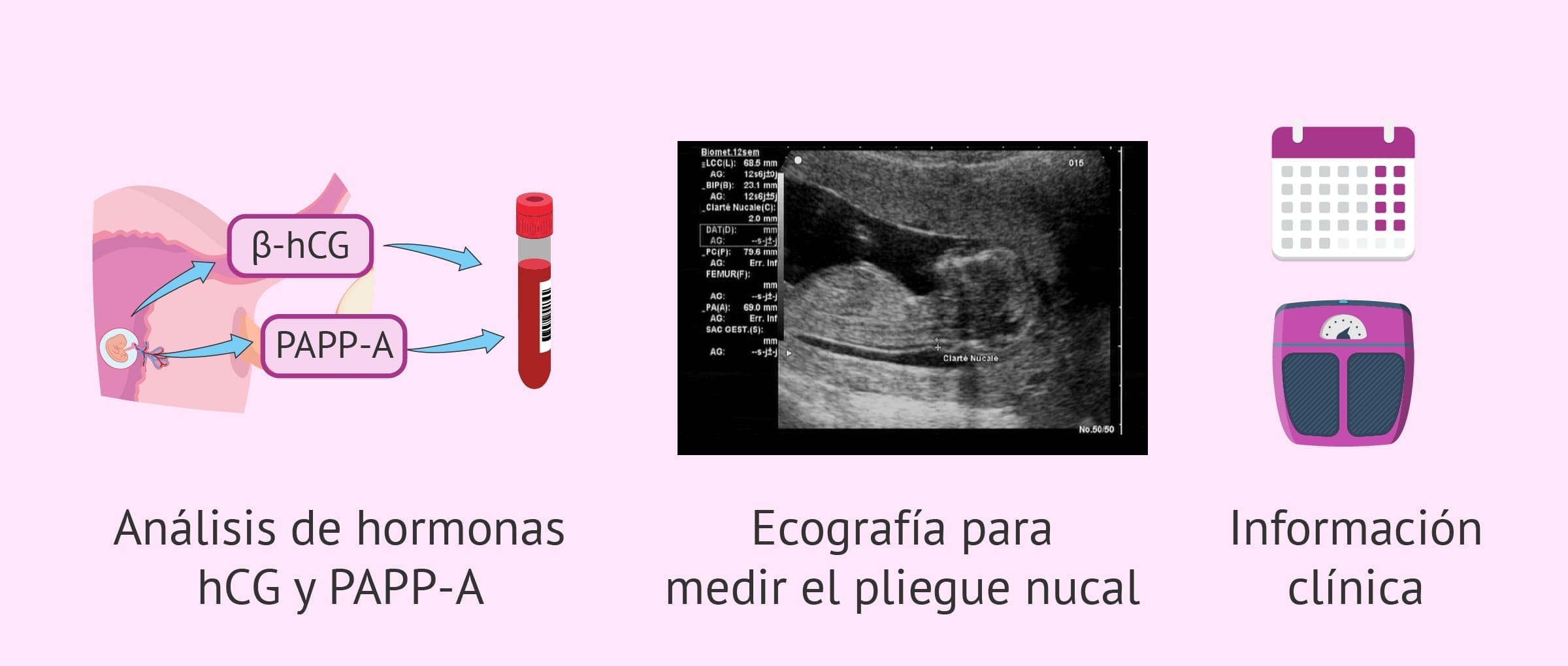 La translucencia nucal y el cribado combinado del primer trimestre