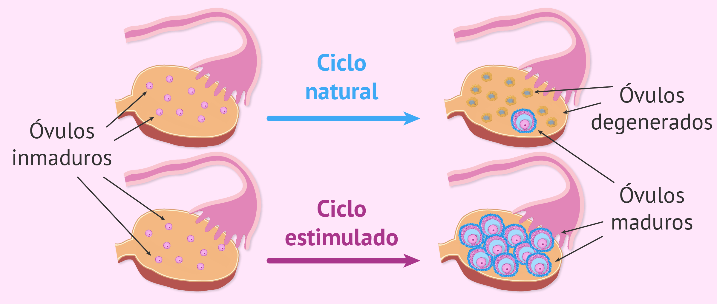 Medicamentos para la estimulación ovárica