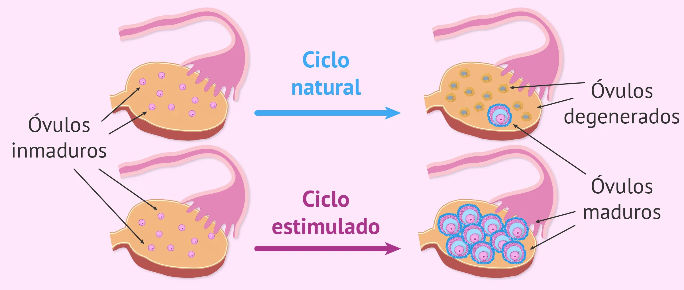 Medicamentos para la estimulación ovárica