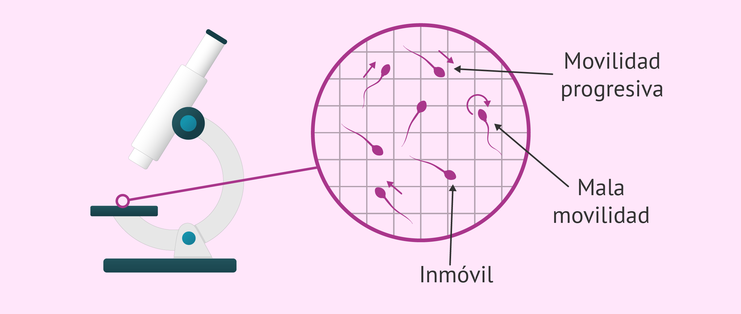¿Qué es la astenozoospermia? - Definición, causas y tratamiento