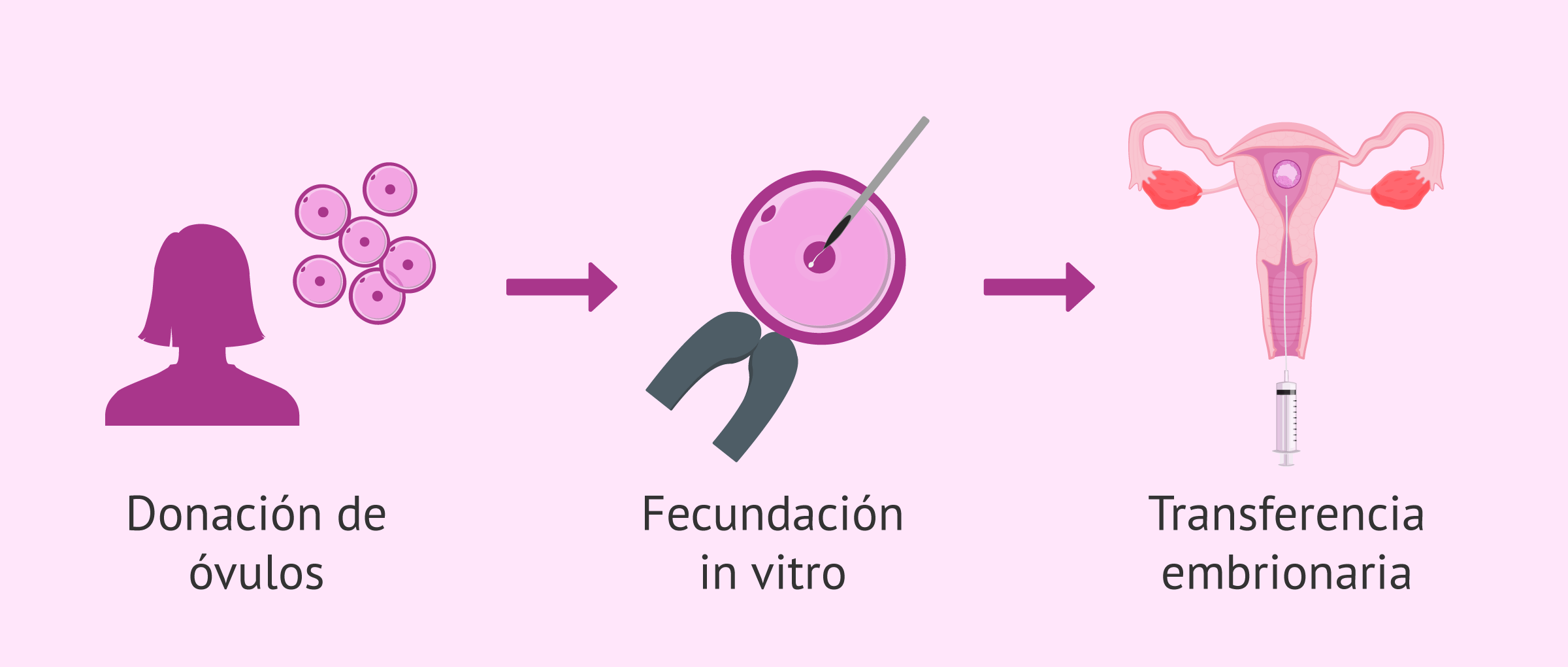 FIV con ovodonación
