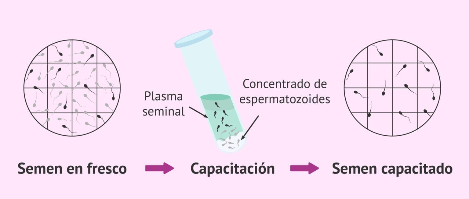 Resultados Del Seminograma REM Resultados Del Seminograma REM
