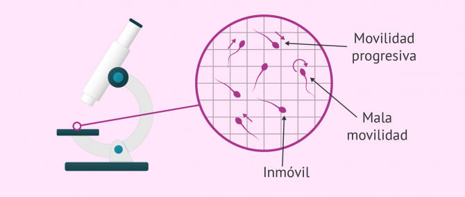 Imagen: Análisis del movimiento de los espermatozoides