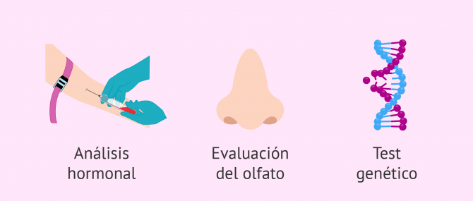 Imagen: Diagnosticar el S. Kallmann