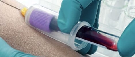 Test análisis glóbulos blancos