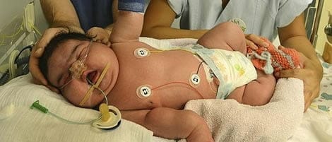 Bebé gigante en Alemania