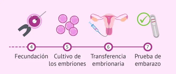 Imagen: Embarazo ectópico posible consecuencia de un proceso de fiv
