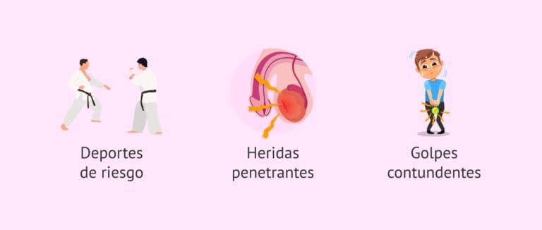 ¿Una patada en los testículos produce infertilidad masculina?
