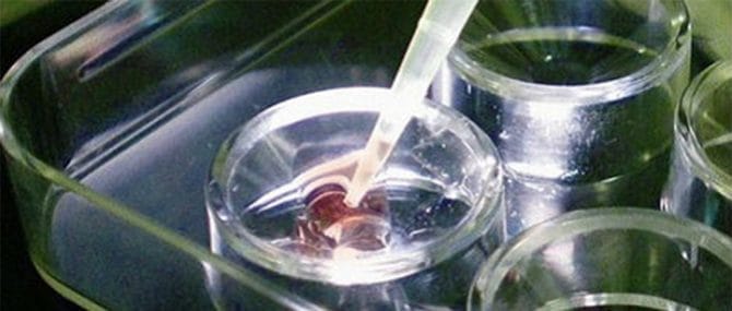 Imagen: El semen congelado disminuye las posibilidades de un embarazo por fecundación in vitro