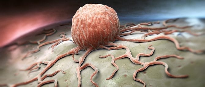 Imagen: Las células cancerígenas puedan afectar al feto a traves de la placenta