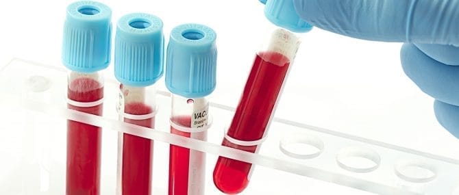 Imagen: Diagnostocar Síndrome de Down