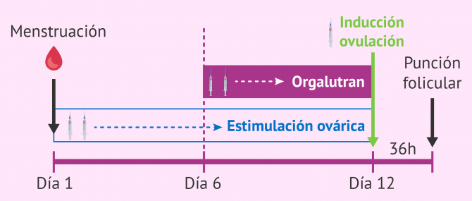 Imagen: Ciclo corto con Orgalutran