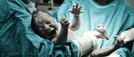Bebés prematuros por parto vaginal