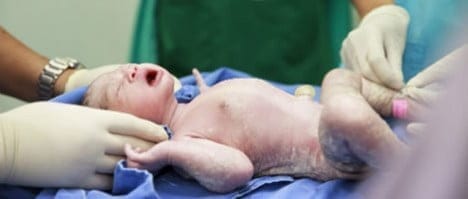 Parto vaginal para prematuros