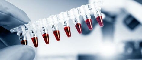 Secuenciación genómica