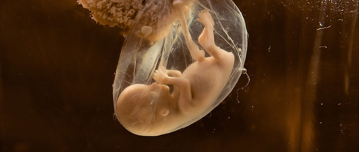 La reforma sanitaria en relación al aborto en EEUU