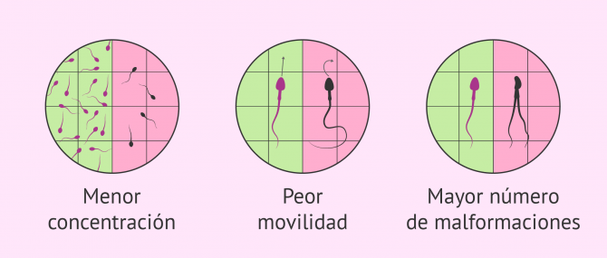 Imagen: Alteraciones espermáticas