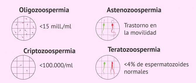 Imagen: Alteraciones en el semen