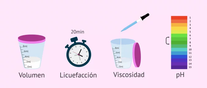 Imagen: Seminograma