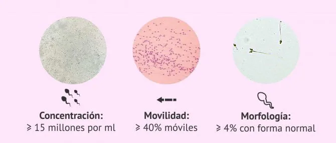 Imagen: Estudio microscópico del semen