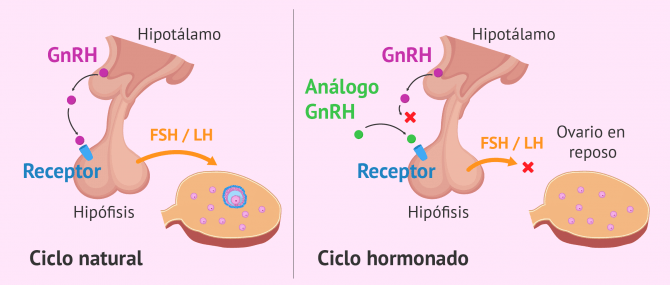Imagen: Indicaciones de los análogos de Gnrh