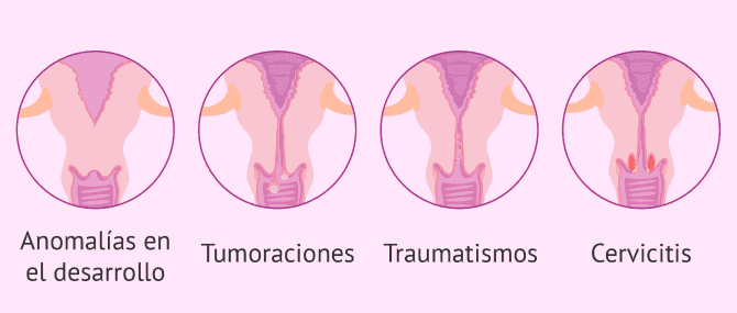 Imagen: Paso de los espermatozoides