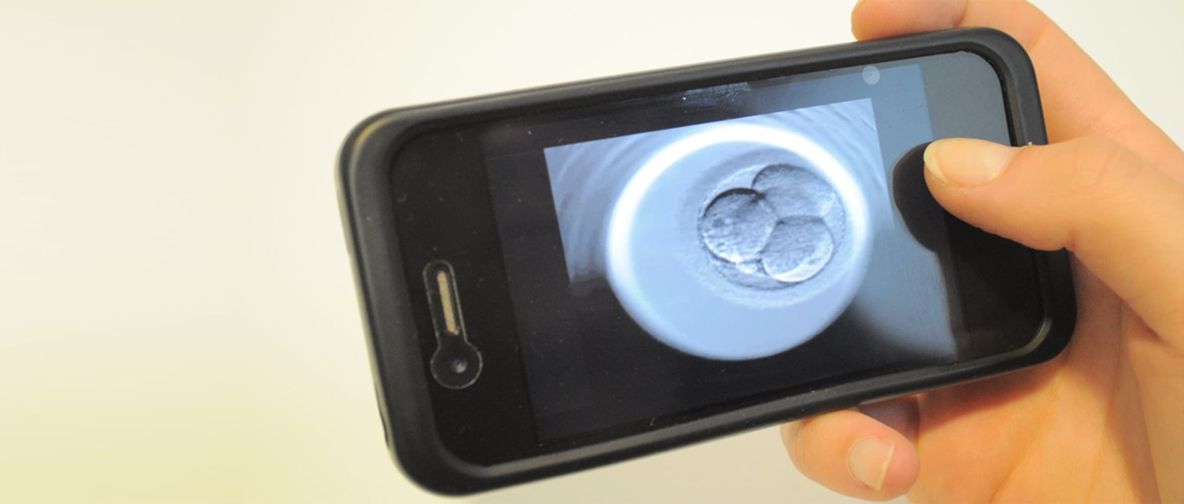 El Embriomóvil, tecnología innovadora para tranquilizar a los futuros padres